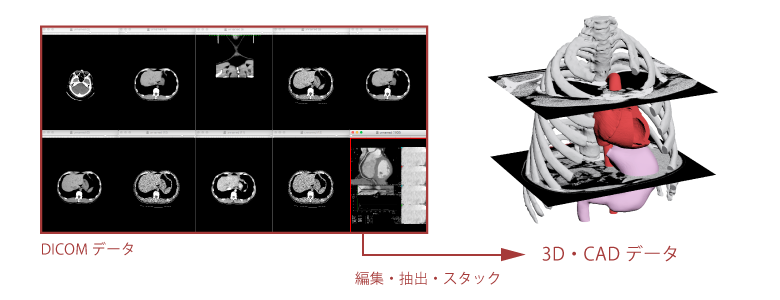 DICOMデータから3D・CADデータへ変換