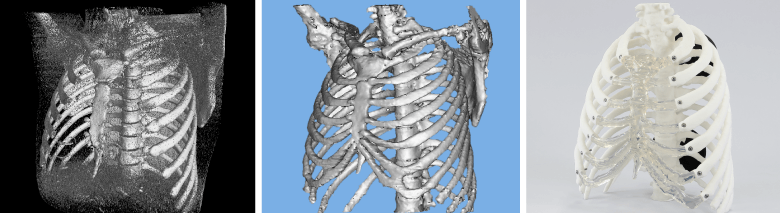 CT撮影から3Dデータ化されたデータを3Dプリンターで出力