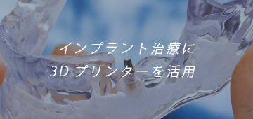 インプラント治療に3Dプリンターを活用