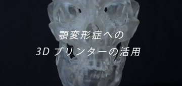 顎変形症への3Dプリンターの活用