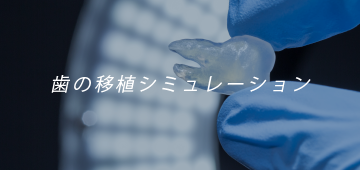 歯の移植シミュレーション