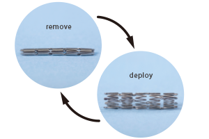 removeとdeployの出来るリユーザブルステント