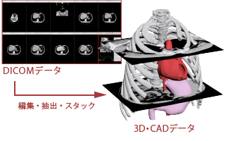 DICOMデータから3D・CADデータへ変換