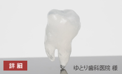 ゆとり歯科様の歯の移植術前シミュレーター