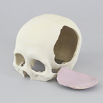 3Dプリンター石膏造形で出力された、リアルな頭蓋骨術前シミュレーションモデル